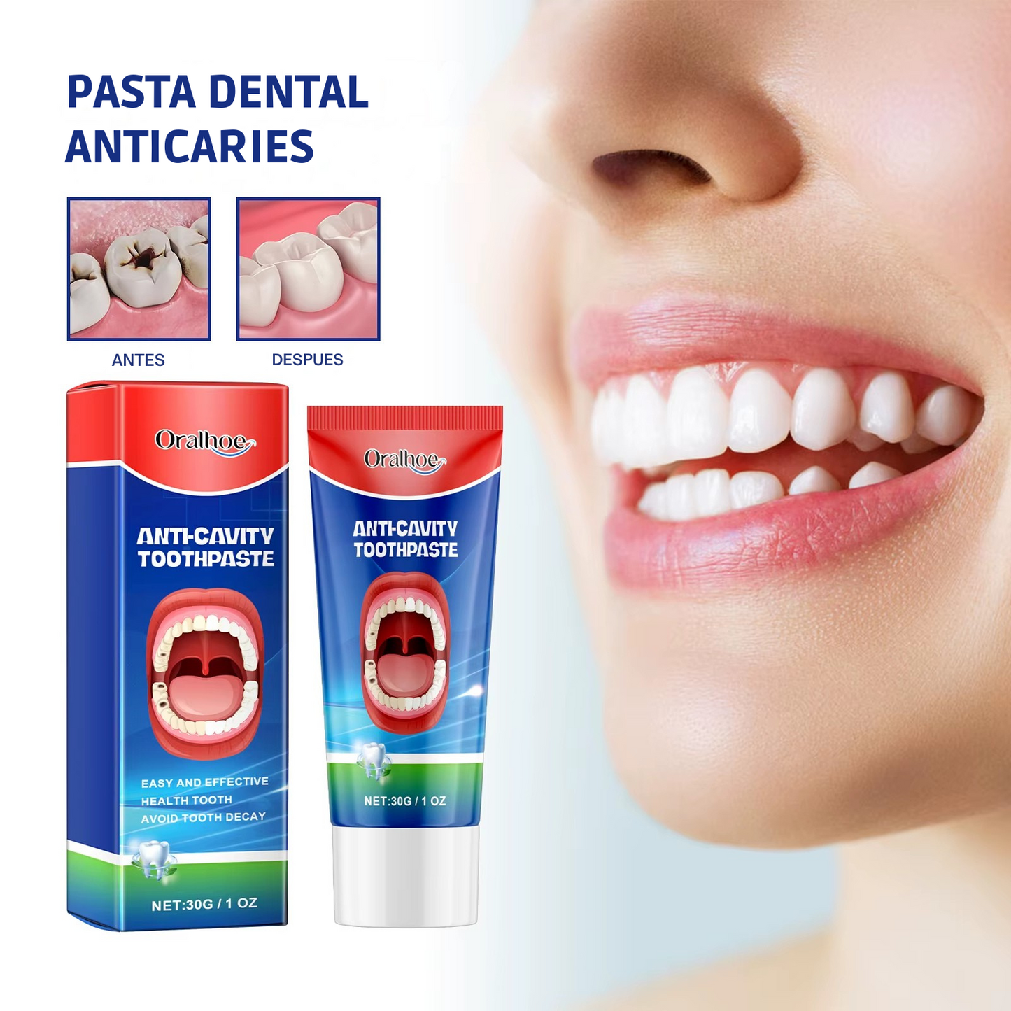 Anticavity Toothpaste - OralCare™