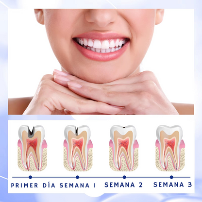 Anticavity Toothpaste - OralCare™