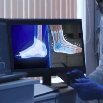 Calcetines De Neuro Compresió - Sereni Vida™.